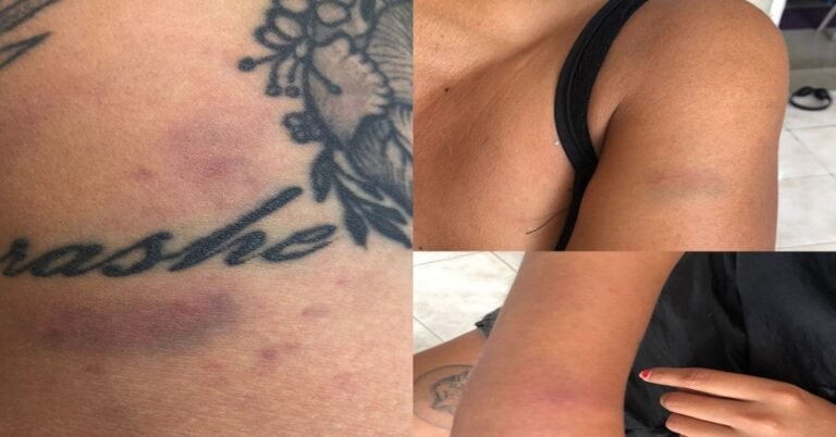 PAMELA VICTIMA DE GOLPES Y ABUSO DE AUTORIDAD POR PARTE DE LA POLICIA ESTATAL SSP