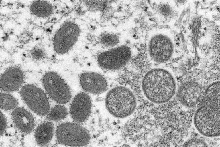 EU declara emergencia sanitaria por brote de viruela del mono